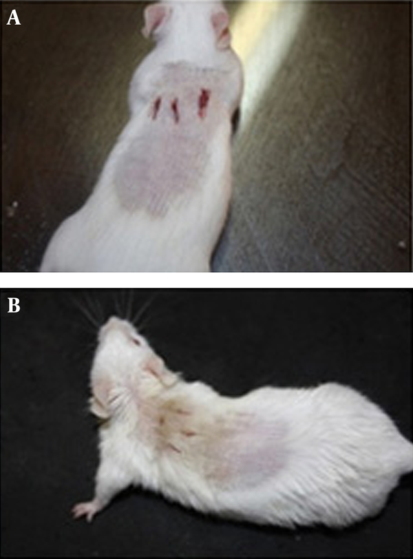 A, was treated with Eucerin alone (control); B, was treated with the MBP-1 and silver nanoparticles combination.