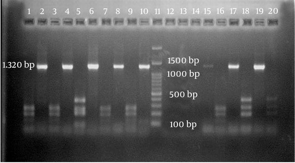 Lanes 1, 3, 7, 9, and 16, genotype I; lanes 2, 4, 6, 8, 10, 15, 17, and 19, cagA gene without HinfI restriction enzyme; lane 5, genotype III; lane 11, DNA ladder (100 bp); lanes 18 and 20, genotype II.