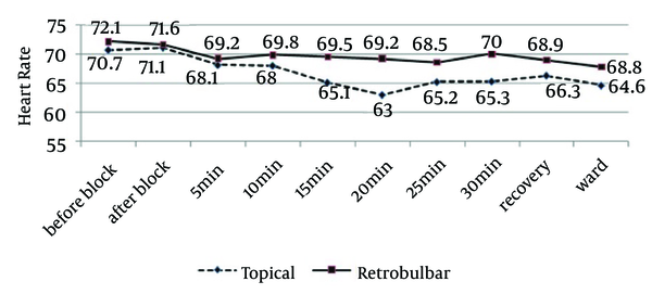 Comparing Heart Rate of Patients in Time Intervals in the Two Groups of Cataract Surgery (Phaco) Using Topical Anesthesia and Retrobulbar Block