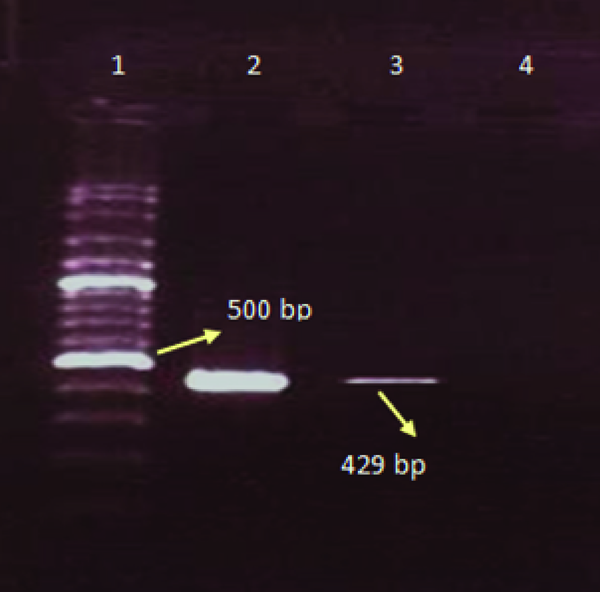 Lane 1: 100-bp DNA size marker, Lane: 2 positive control, Lane 3: influenza type B, Lane 4: negative control.