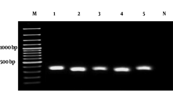 Lanes: M, 100 bp DNA Ladder; 1 - 5, PCR products of blaOXA-51-like gene (353 bp); N, negative control (A. lwoffii).
