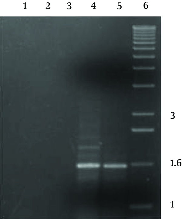 PCR products were visualized by gel electrophoresis. Lanes 1, 2 and 3 show the results of the PCR in the absence of genomic DNA (lane 1) or with the primer (lanes 2 &amp; 3). Lanes 4 and 5 show the PCR products obtained from the primers, and both used genomic DNAs of environmental and pathogenic A. fumigatus respectively. Lane 6 shows the molecular weight marker, with band sizes (Kb) indicated at the right. The +sign indicates the direction of the positive electrode during electrophoresis.