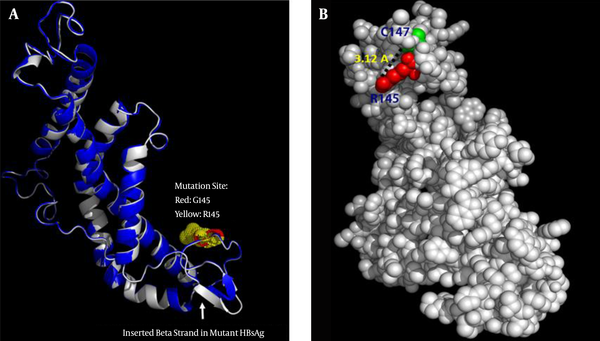 A, Superposition of the wild-type HBsAg (blue) and the G145R mutant (gray). The arrow indicates the position of the inserted β-strand in the mutant HBsAg’s “a” determinant region. B, Representative positioning of the H-bond between the R145 and C147 mutation in the 3D structure of the G145R mutant HBsAg.