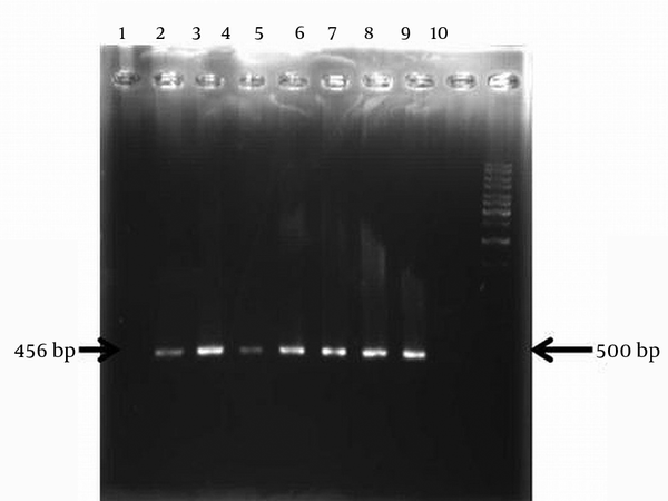 Lane 1 isolate negative for aacC1 gene, Lane 2-8 isolates with aacC1 gene, Lane 9, no DNA and Lane 10 related to size marker (1 kb DNA ladder).