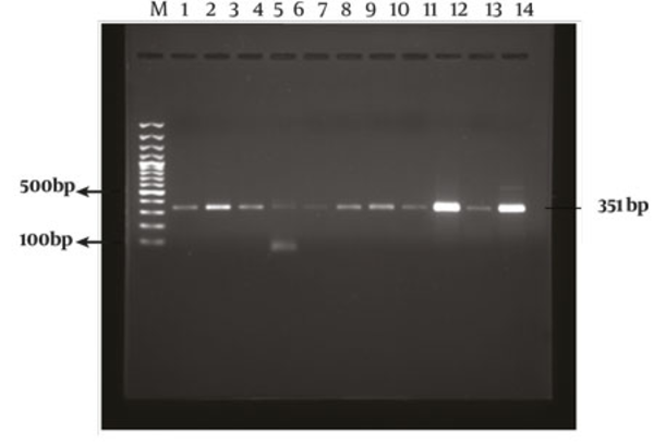 The PCR Amplification of Sb83 Genotype