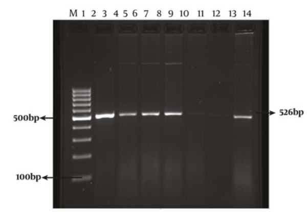 The PCR Amplification of Sb227 Genotype