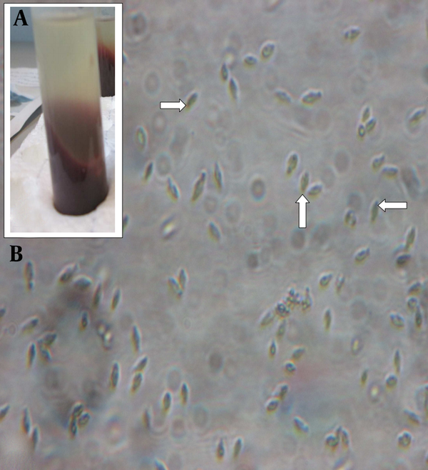 Culture of Patient Specimen in NNN Medium A, and Detection of the Leishmania Promastigote by Direct Microscopic Method B.