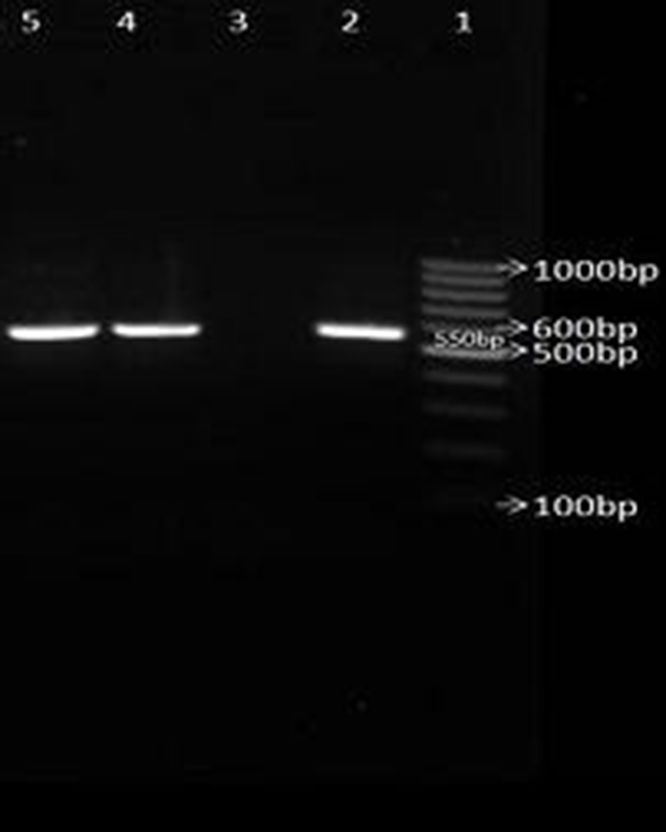 No.1: DNA marker (100 bp), No 2: positive control for blaCTX-M, No. 3: negative control No. 4,5: isolates with blaCTX-M (550 bp) gene.