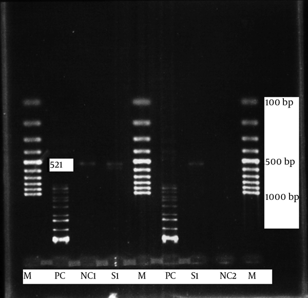 The 521bp fragment of the 23SrRNA gene amplified by PCR from the B. pertussis clinical isolates and controls; Abbreviations: B. pertussis, Bordetella pertussis; PCR, polymerase chain reaction.