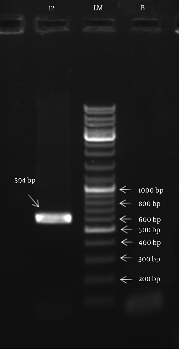 Lane LM: Molecular Weight Marker (100 bp DNA Ladder); Lane 12: Integrase Gene PCR Product (594 bp); Lane B: Negative Control.