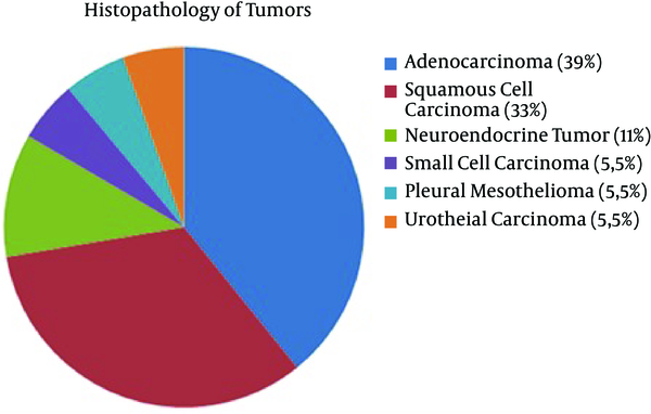 Histopathological Types and Percentages of Tumors
