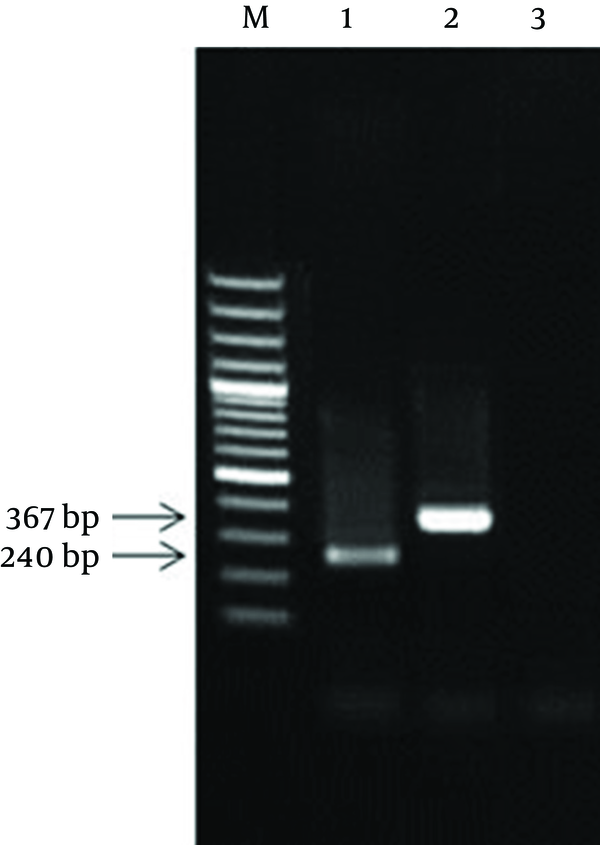 M: 100 bp DNA Marker; 1: PCR product of the diagnostic 16SrRNA; 2: PCR product of the IPC plasmid; 3: PCR negative control.