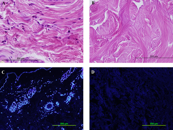 Verifying decellularization by 0.1% SDS for 48 hours by H&E staining (A,B) and DAPI staining (C,D). Comparison between sections before decellularization (A,C) and after it (B,D) shows complete decellularization.