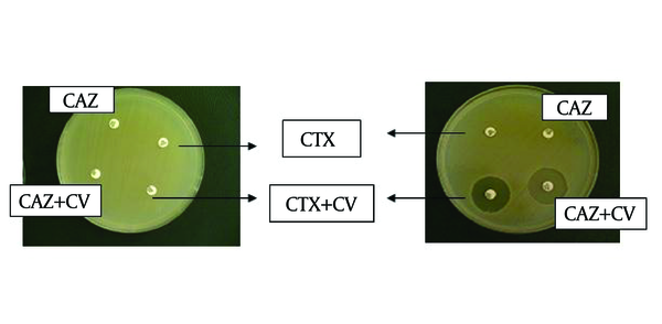 Right figure: Positive ESBLs phenotypic test  Left figure: Positive AmpC phenotypic test  CTX: cefotaxime, CAZ: ceftazidime, CV: clavulanic acid