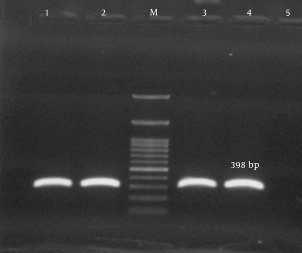 Lane M, 100-bp DNA ladder (Fermentas, UK); lanes 2 - 4, the 180-bp PCR product of tsst-1; lane 1, the positive control; lane 5, the negative control.