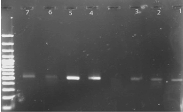 PCR Results on Agarose Gel