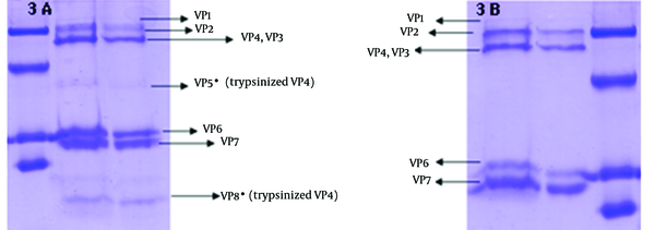 A: TLP of trypsinized human rotavirus particle in which the VP4 protein was cleaved to VP5* and VP8*; B: TLP of not trypsinized human rotavirus with an intactVP4.