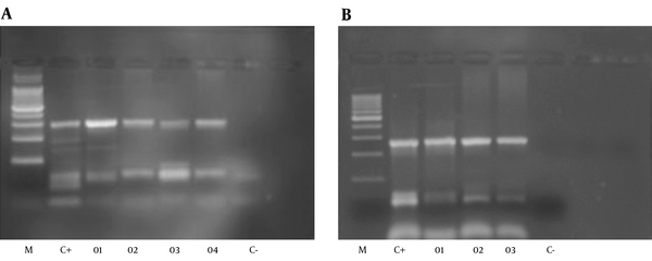 A, Amplification of jhp0917 gene of H. pylori (307 bp), M: 100 bp ladder, size marker, C+positive: 26695, J99,SS,01 to 04: positive samples and C-negative control; B, Amplification of jhp0918 gene of H. pylori (276 bp). M: 100 bp Ladder, size marker, C+positive: 26695,J99,SS,01 to 03: positive samples and C- negative control.