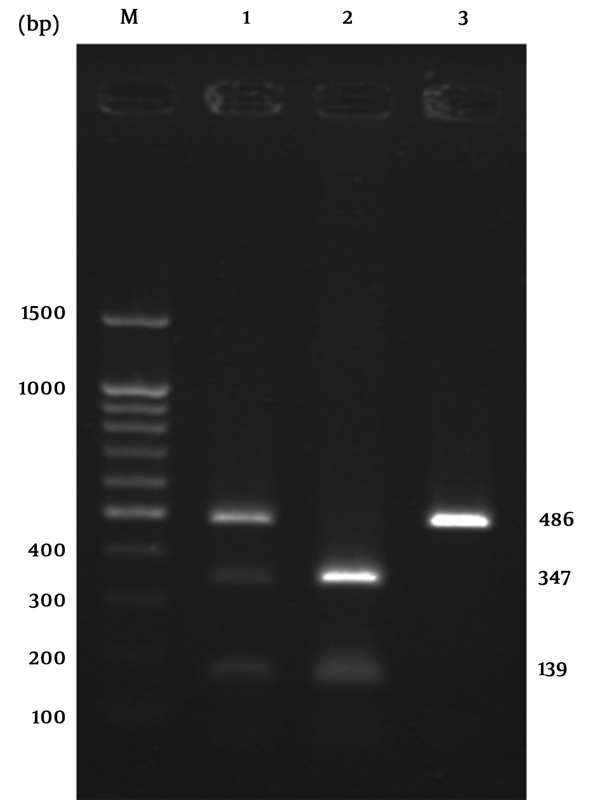 M, DNA ladder; 1, AG genotype; 2, AA genotype; 3, GG genotype.