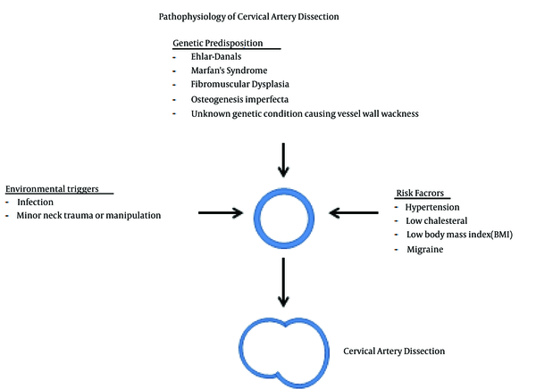 Pathophysiology of Cervical Artery Dissection Showing the Interplay Between Genetic Predisposition and Environmental Triggers and Risk Factors