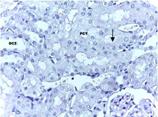 The normal reaction of brush border to PAS staining is shown. Arrow: PAS × 40.