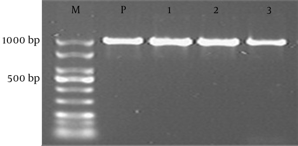 Lane M, DNA size marker; lane P, positive control; lane 1, 2, and 3: vanA (1030 bp) gene positive isolates.