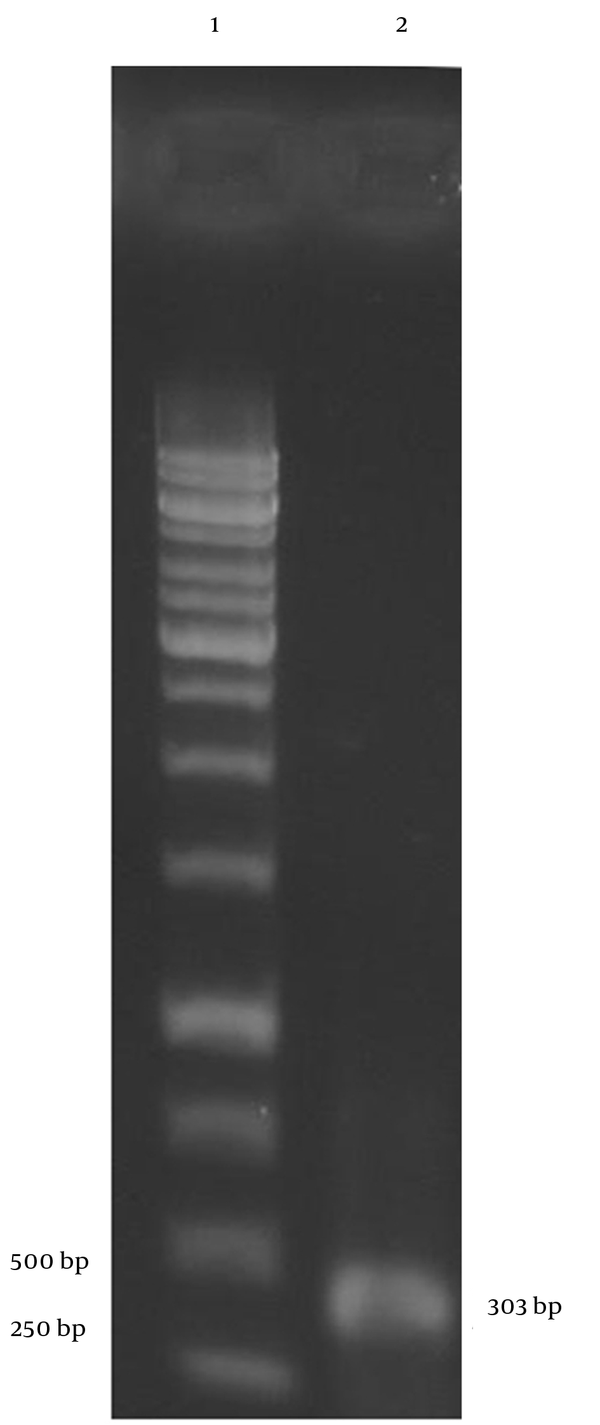 Lanes 1 and 2 correspond to a 1-kbp DNA ladder and the PCR products of the CFP10-coding region, respectively.