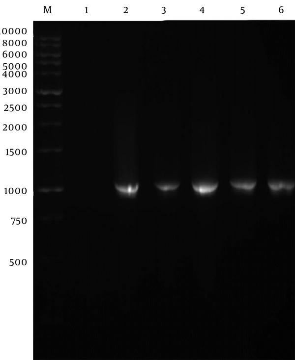 M, 1 kb DNA ladder; Lane 1, negative control; Lane 2 - 6: selected pVAX1-SAG1 recombinant plasmids.