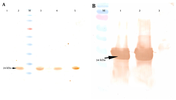 A) Detection of the PapG protein with anti-6 his antibody revealed a 24-kDa band in western blotting. Lane 1: un-induced sample. Lanes 2, 3, 4, and 5, induced samples as negative controls; M, protein size marker. B) Analysis of the PapG.AcmA protein versus the anti-6 his antibody showed a 34-kDa band in western blotting. Lanes 1 and 2, induced samples; Lane 3 un-induced sample as a negative control; M, protein size marker.