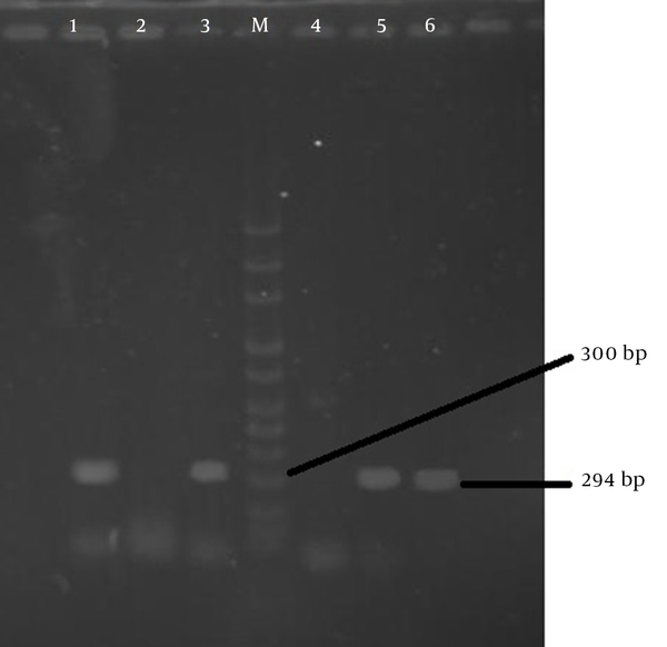 M (100 - 3000 bp DNA size marker), lanes 1, 3, 5 and 6 are clinical isolates of positive ETBF gene.