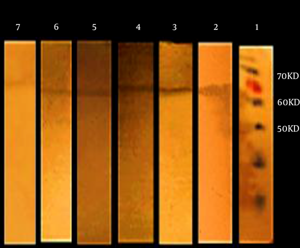 Lane 1, protein marker; Lane 2 - 7, western blotting using the patients’ samples.