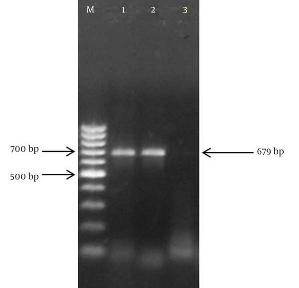 M, 100 bp marker; 1, HCMV positive control; 2, Iranian HCMV sample; 3, negative control.