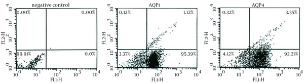 The AQP1 antibody detected two bands of approximately 27 and 32 kDa (Lane 1). A peptide of approximately 29 kDa was identified by the AQP4 antibody (Lane 2). The antibody against AQP5 recognized a slim band of approximately28 kDa (Lane 3).