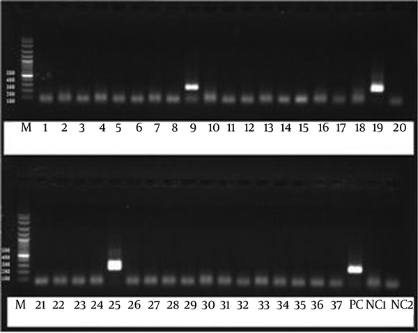 Lower row; M: 100 bp ladder, 25: P. jirovecii isolated from HIV+TB+ patient, PC: positive control, NC1&amp; NC2: negative controls. Upper row; M: 100 bp ladder, 9 &amp; 19: P. jirovecii DNA isolated from two HIV+TB+ patients.