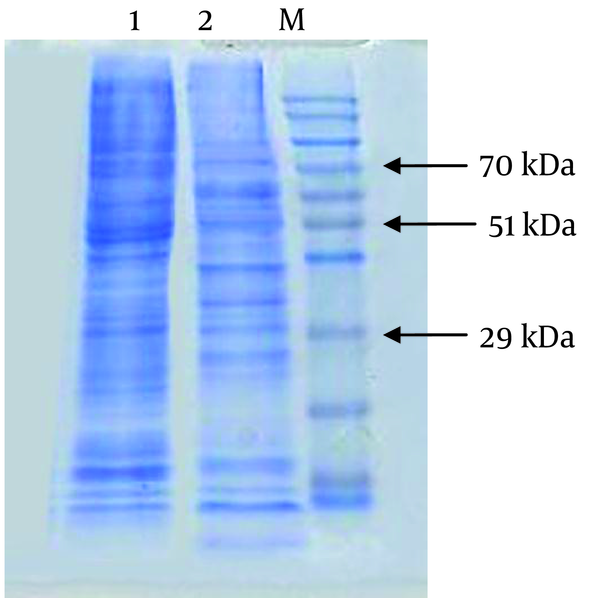 Lane 1, Uninfected Sf9 cells as control. Lane2, Lane M is protein marker (Vivantis).