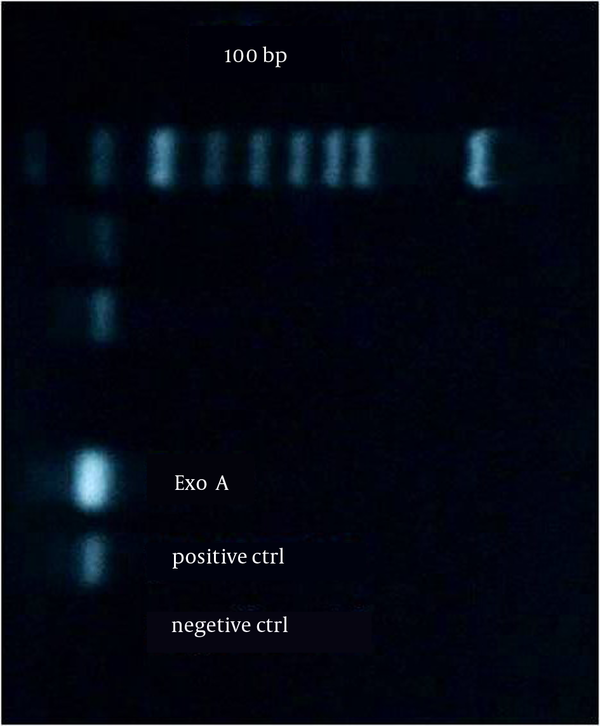 Gel Electrophoresis of the Polymerase Chain Reaction Products Using exoA Gene-Specific Primers