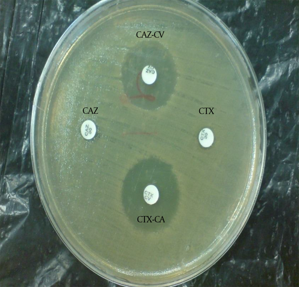CAZ, ceftazidime; CAZ-CV, ceftazidime-clavulanic acid; CTX, cefotaxime; CTX-CV, cefotaxime-clavulanic acid; No growth inhibition zone around the single disk of ceftazidime and cefotaxime indicates bacterial resistance. The growth inhibition zone around the ceftazidime and cefotaxime disks in combination with clavulanic acid shows the sensitivity of the bacteria to the combination disks and confirms the production of ESBLs by the isolate.