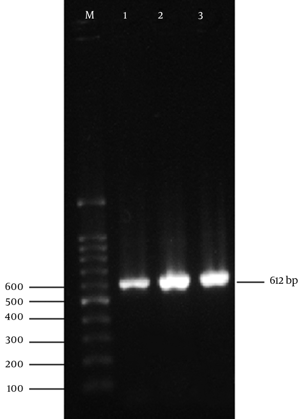 Lane M, 100 bp ladder marker; lane 1, positive control; lane 2, 3, E. coli 16s rRNA  gene gound at 612 bp.