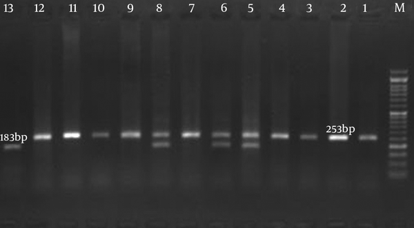 Lane M, molecular maker (Gene ruler 50-bp DNA ladder plus); lanes 1, 2, 3, 4, 7, 9, 10, 11, and 12 RP*1/RP*1 genotype; lanes 5, 6, and 8 RP*1/RP*2 genotype; and lane 13 RP*2/RP*2 genotype.
