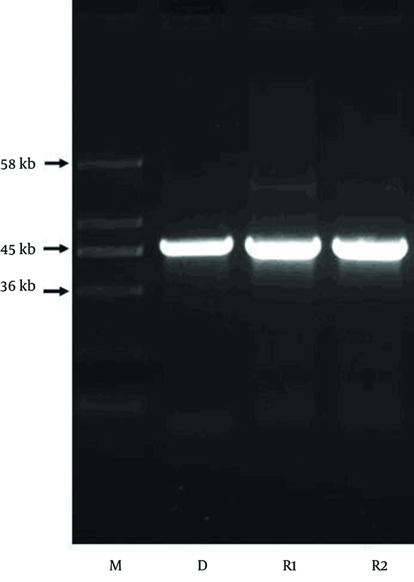 Lane M, molecular size marker; lane D, plasmid fragment of E. coli CP9 as a donor; lane R1 and R2, trans conjugants of E. coli DH5α obtained using E. coli CP9 as a donor.
