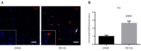 A, blast exposure revealed an elevated fluorescence of T22 (oligomeric tau); B, A significant increase in T22 total cell fluorescence was measured at 72 hours post-blast (*P &lt; 0.001 vs SHAM). Two-tailed Standard t-test. Mean ± sem. n = 5.