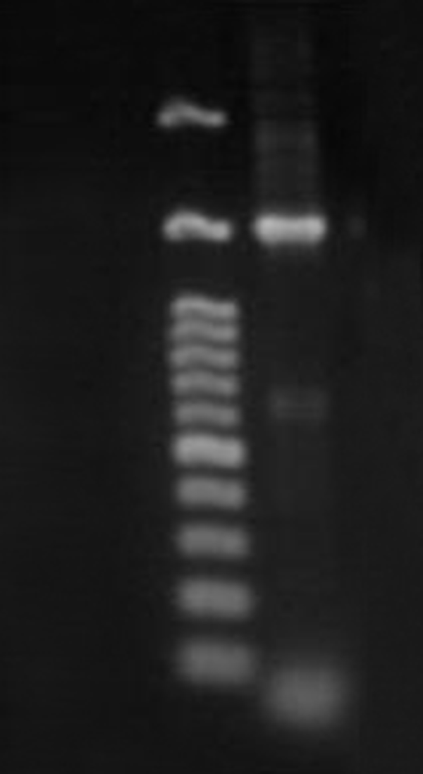 Agarose gel (1%) Showing PCR Products (1.5 Kb) of ACTK2 strain S. flavogriseus, Along with Marker DNA (2.0 kb).