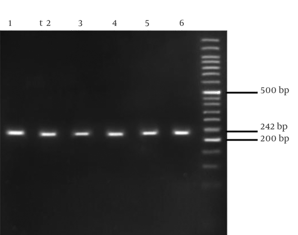 The PCR product size was 242 bp.