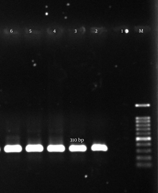 M, ladder 100 bp; lane 1, negative control; lane 2, positive control S. aureus (ATCC700698); lanes 3 – 6, clinical samples.