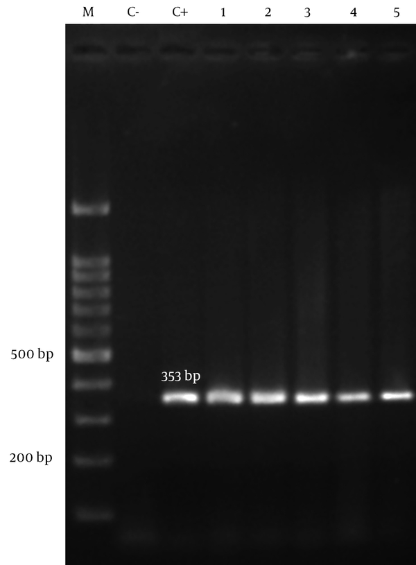 1, 2, 3, 4, 5, clinical isolates of A. baumannii with blaOXA-51-like gene; C-, negative control; C+, positive control; M, 100 bp DNA ladder.