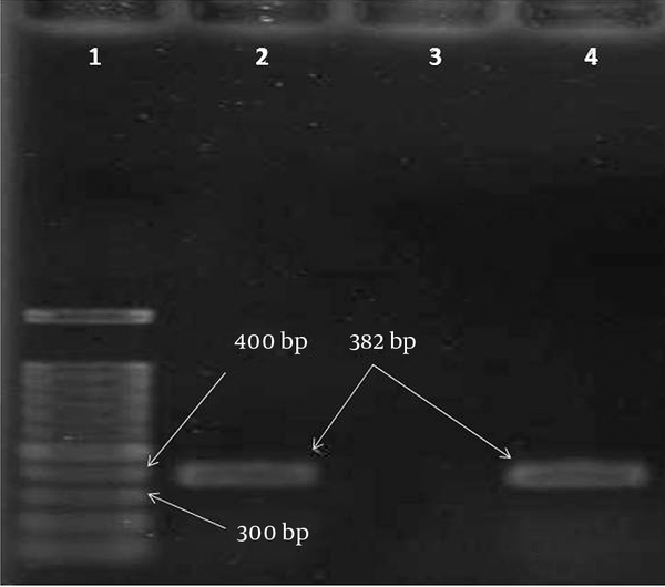 Electrophoresis of Polymerase Chain Reaction Products for the blaVIM Gene among the Pseudomonas aeruginosa Isolates