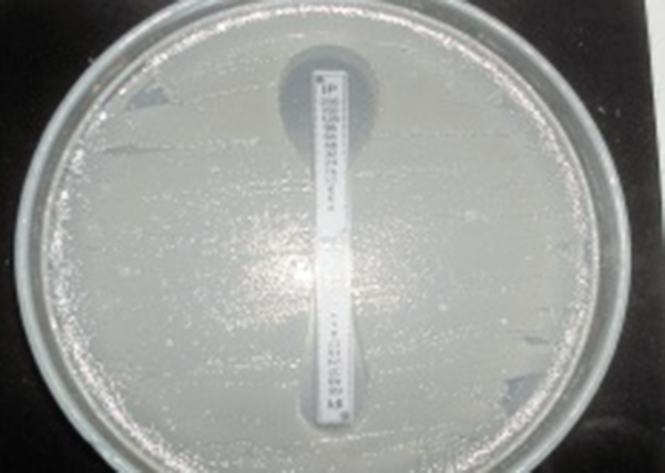 The top of the E-test tape shows sensitivity to imipenem with EDTA, and the other side of the tape shows resistance of Pseudomonas aeruginosa species to imipenem.