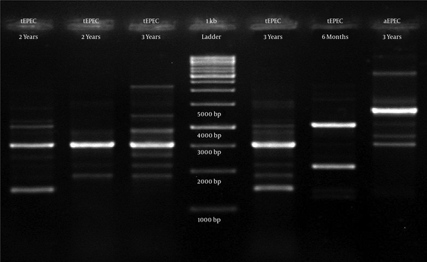 Lane 4, 1 kb DNA ladder (Fermentase, Germany); lanes 1, 2, typical EPEC isolates from two-year-old infants; lanes 3,5, typical EPEC isolates from three-year-old infants; lane 6, typical EPEC isolate from six-month-old infant; lane 7, atypical isolate from three-year-old infant.