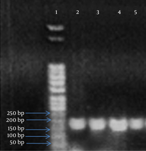 Lane 1, ladder molecular size marker; lanes 2 - 5 are representatives of S. pneumoniae isolates; a PCR product of 160 bp specific to cpsA gene is common to all isolates.