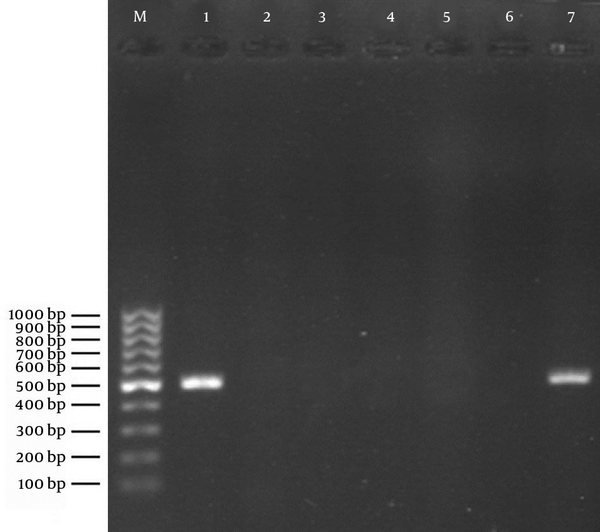 Lane M: 100 bp DNA marker (Fermentas, Germany); Lane 1: positive control of amplified 532-bp DNA (S. aureus ATCC 33591); Lane 2: negative control (reaction mixture without DNA); Lanes 3 - 6: representative S. aureus nasal isolates negative for mecA; Lane 7: the only S. aureus isolate positive for the mecA gene.